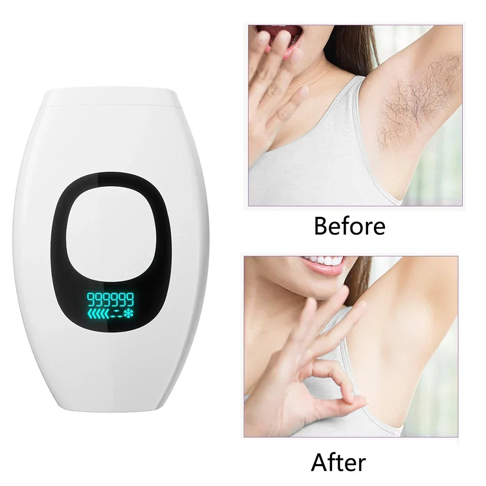 SmoothGlide Painless Laser Epilator